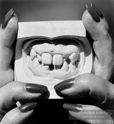 Plaster cast of Tess Gallagher’s teeth. (1989)